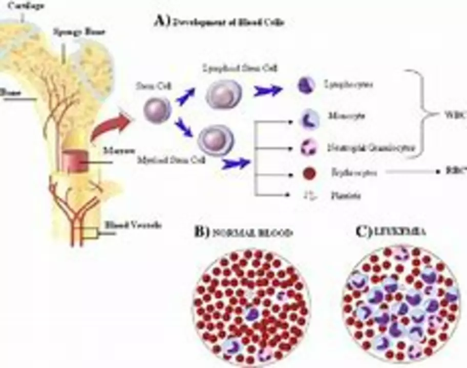 Understanding Bone Marrow Disorders: An Overview